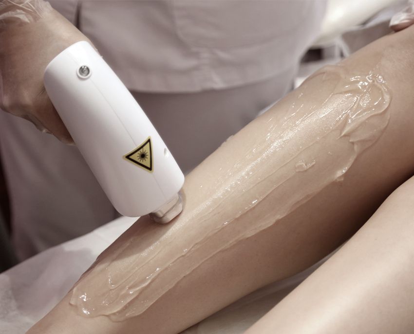 Depilación laser  en Castellón